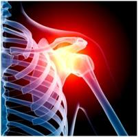 osteoarthrosis of the shoulder joint of 1 degree