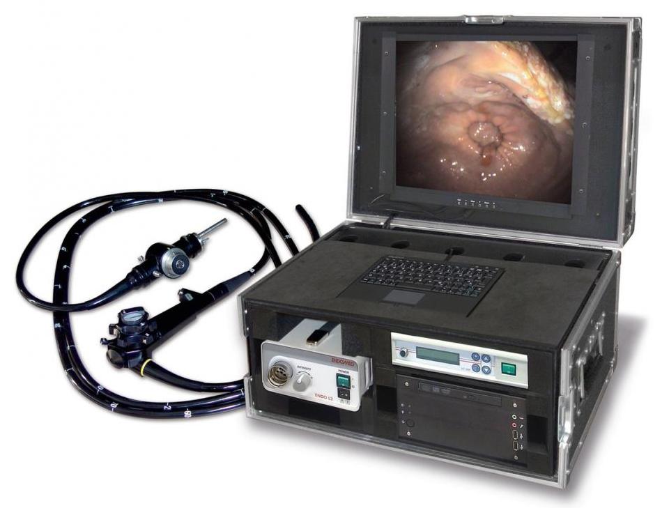 Gastroscope for examinations