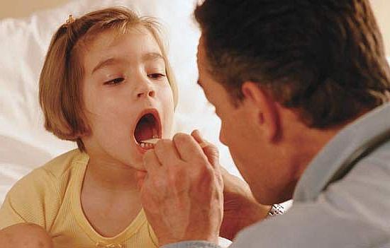 herpes sore throat in children photo