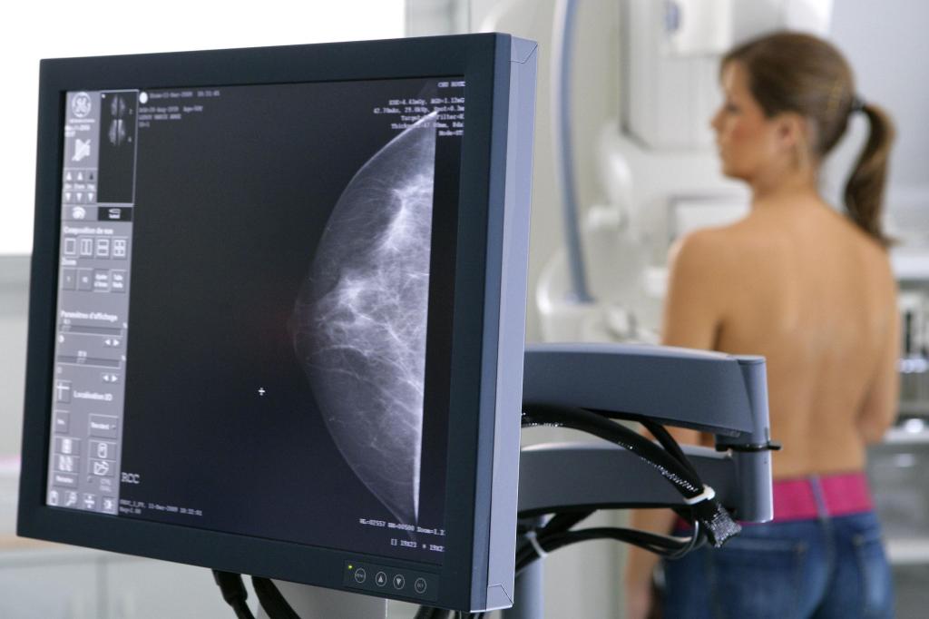 как делают маммографию молочных желез