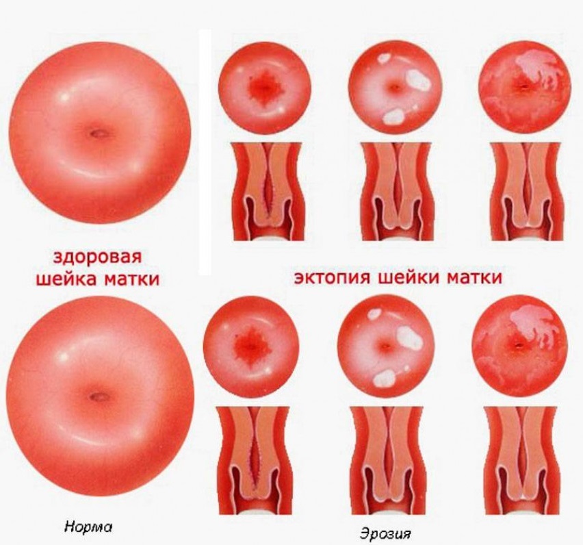 Шейка матки схема
