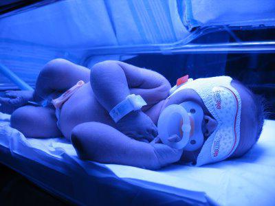 bilirubin general elevated treatment