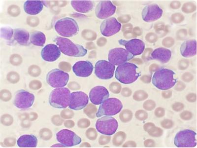 как повысить лейкоциты в крови после химиотерапии