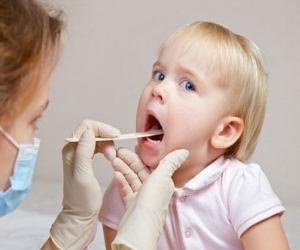 rhinopharyngitis symptoms treatment in children