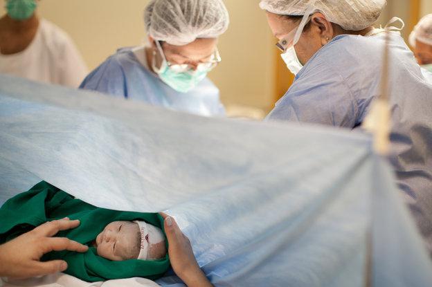 cesarean operation