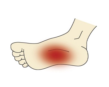 Лечение после растяжения связок на ноге thumbnail