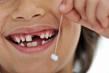 Смена зубов у ребенка 
