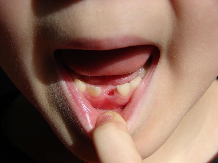 Порядок смены зубов у детей