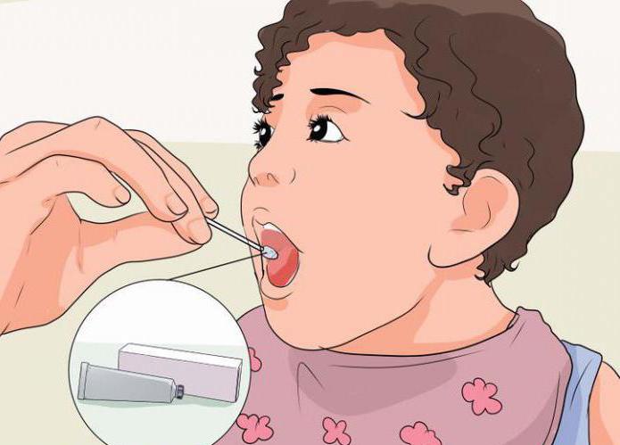 Как вылечить оральную молочницу thumbnail