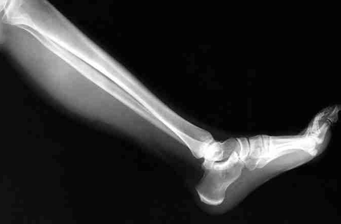 где сделать рентген ноги