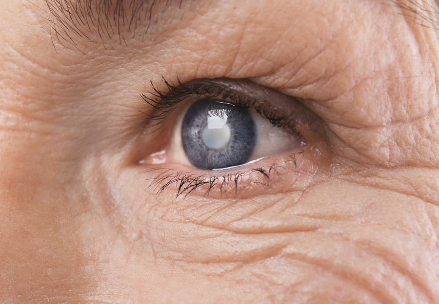 последствия ретинопатии