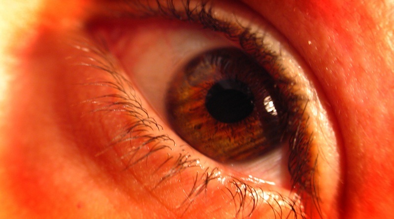 заболевание ретинопатия у пожилых людей