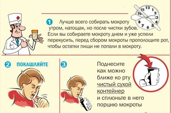 Составьте план подготовки к сбору мокроты на бактериологическое исследование