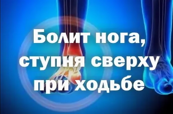 Болит подъем ноги при ходьбе