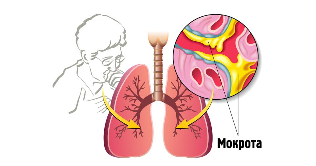 Легкие с мокротой