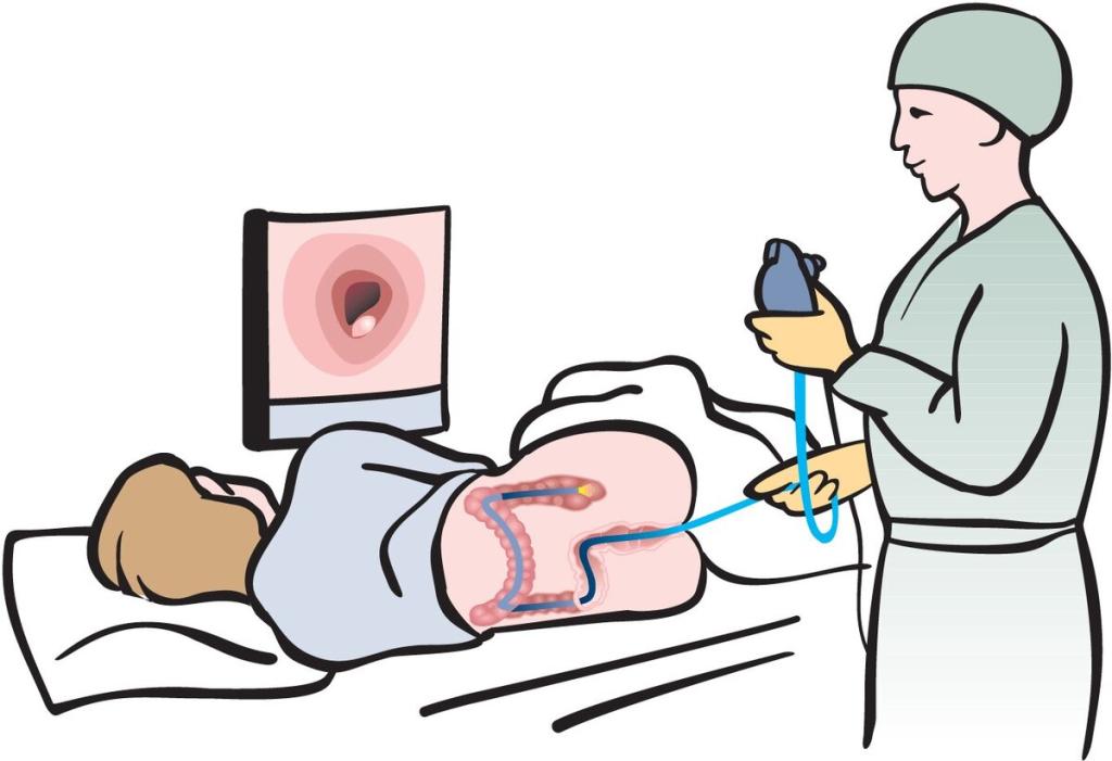 Процедура аноскопии