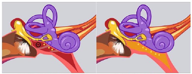 Мышечная составляющая слуховой трубы