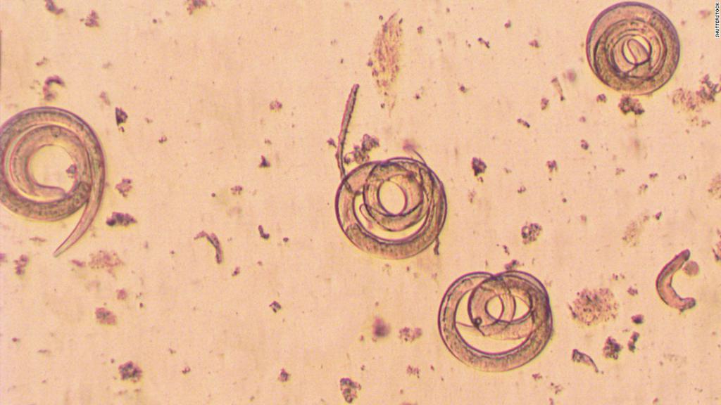 Parasites in the cod liver.