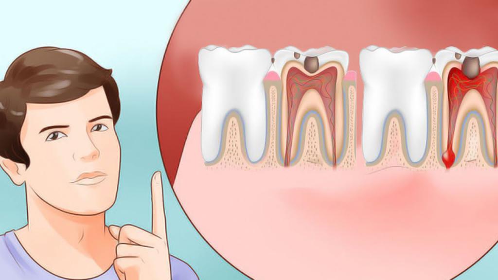 Болит зуб без нажатия