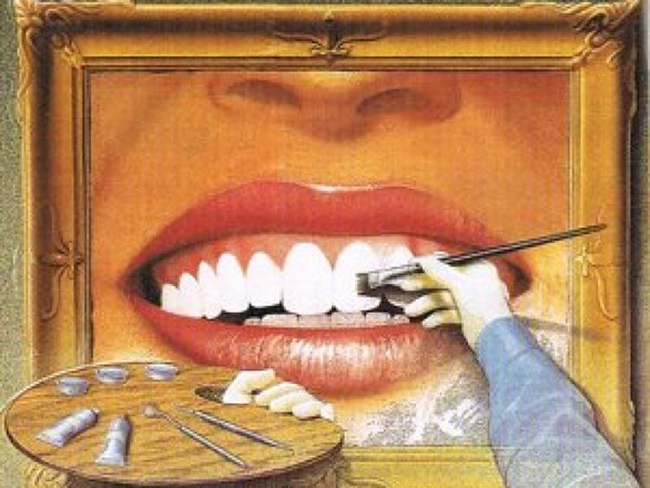 Зуб после резекции верхушки корня.