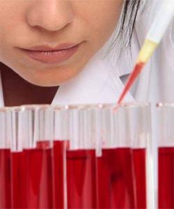 Биохимический анализ крови мочевая кислота