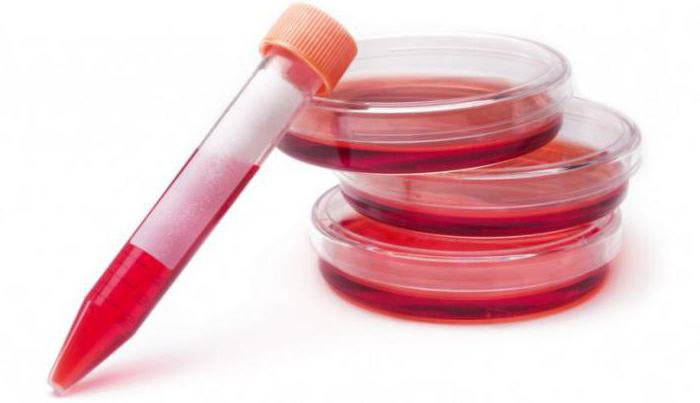 стволовые клетки из пуповинной крови