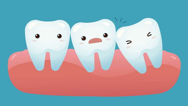 swelling of the cheek after removal of a wisdom tooth