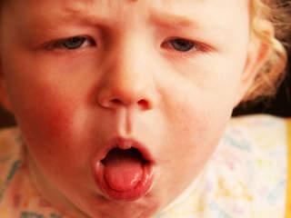 обструктивный бронхит часто у ребенка