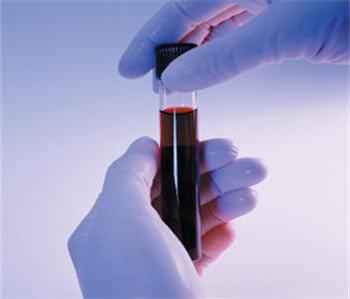 анализ крови триглицериды