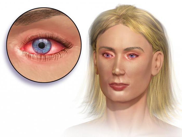 глазные капли полинадим инструкция по применению описание препарата