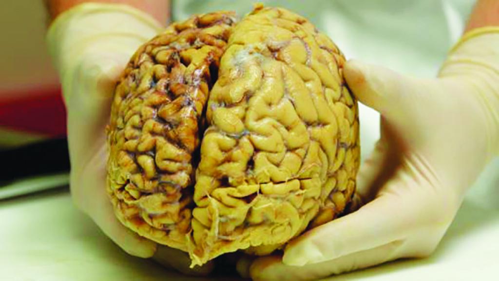 Что такое энцефалопаттия головного мозга