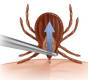 how to remove a tick from a dog