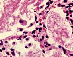 eosinophils elevated in children