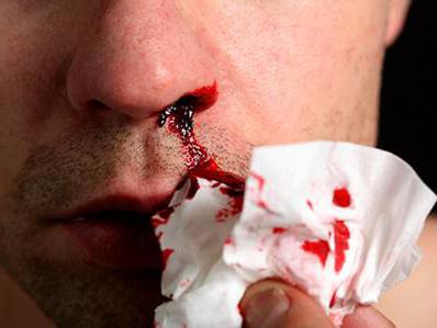 nosebleeds first aid