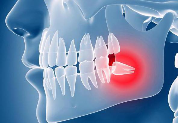 зуб мудрости почему его так называют