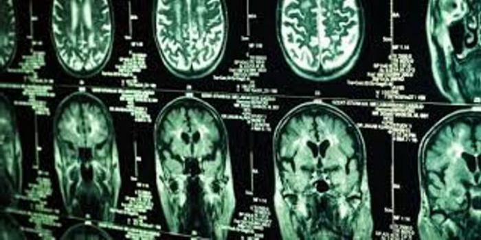 Причины возникновения рака мозга