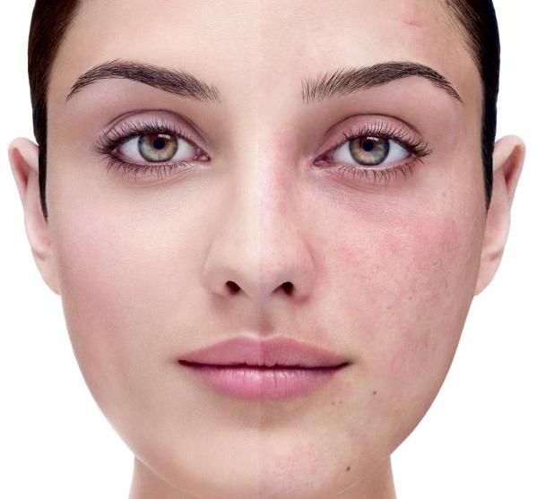 ascorutin for face skin from age spots