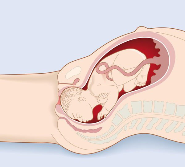 ] how the birth goes from start to finish