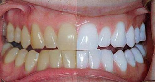 magic white отбеливание зубов отзывы стоматологов