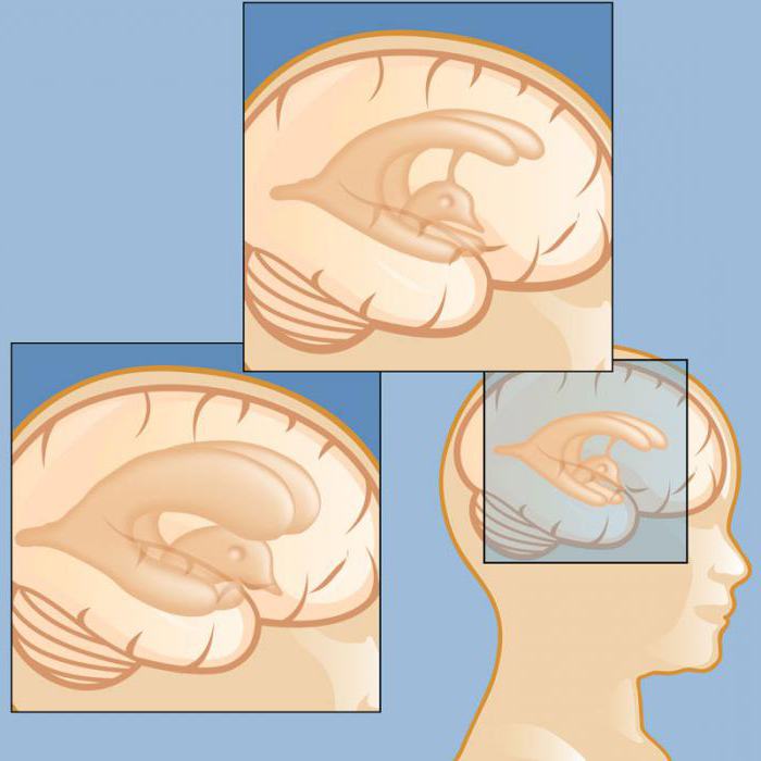 Какие болезни головы бывают и их симптомы thumbnail