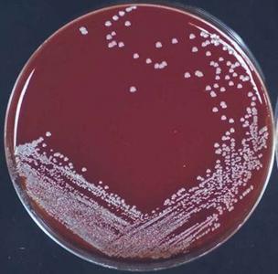 staphylococcus epidermidis