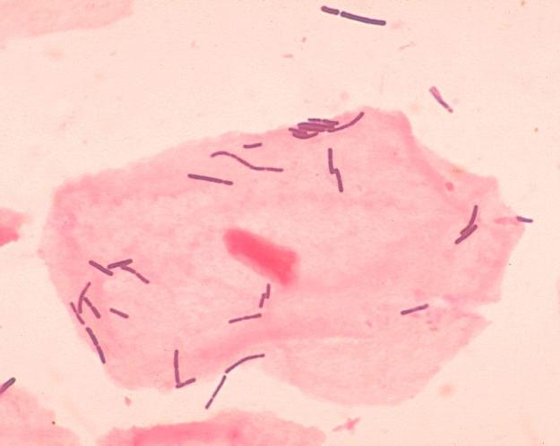 Lactobacillus spp норма у женщин 19