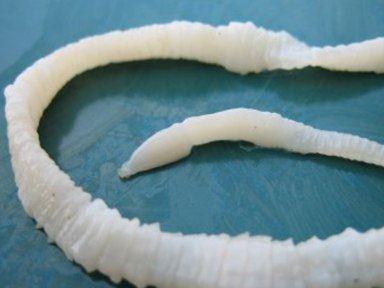 виды червей в организме человека