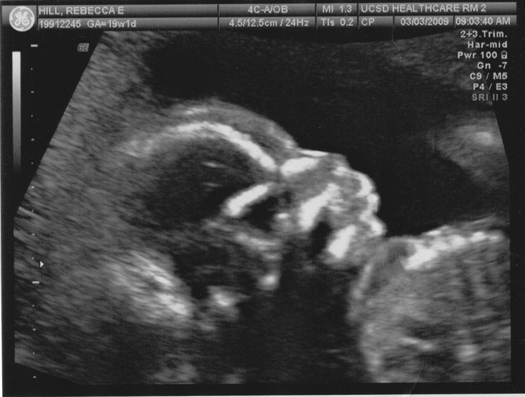 19 Недель беременности фото плода на УЗИ