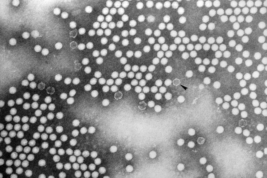 вирус полиомиелита