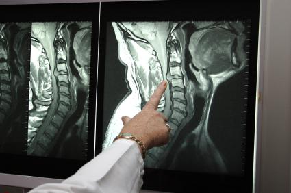 МРТ спинного мозга и позвоночника пояснично - крестцового отдела 