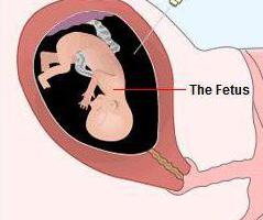 Нормы первого узи при беременности 26