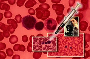 анализ крови на ревмопробы