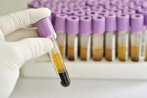 РСТ анализ крови расшифровка понижен
