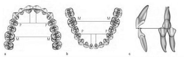 определение центрального соотношения беззубых челюстей 